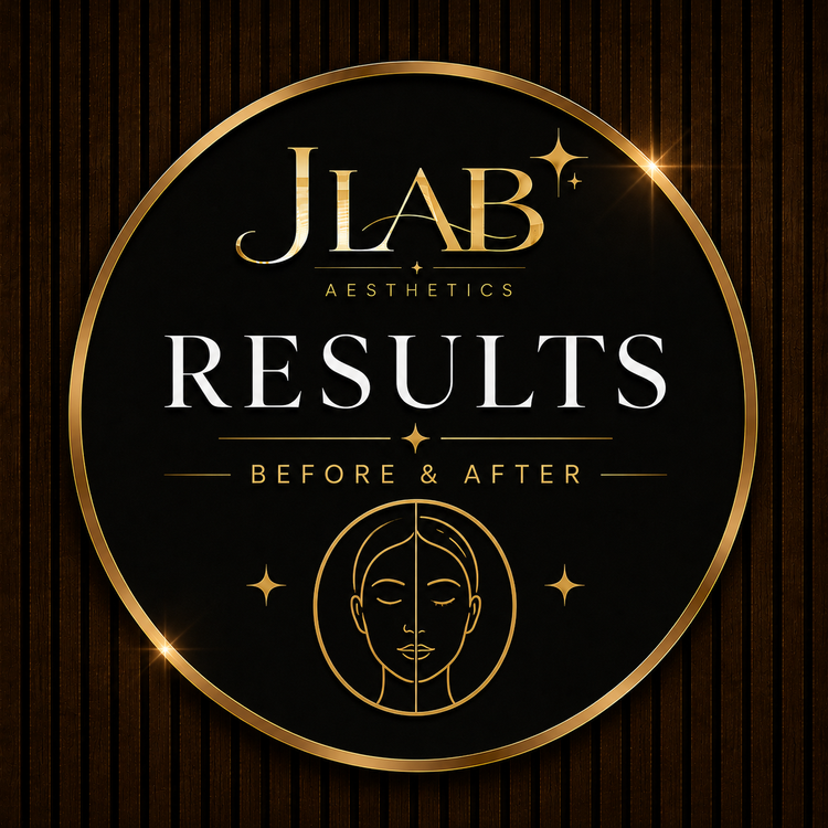 Results Before and after JLAB Burton on Trent